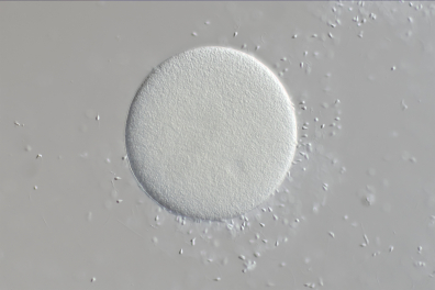 Fécondation chez l'Oursin (Sphaerechinus granularis) x100